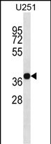 Rabbit Polyclonal Antibody to CD320