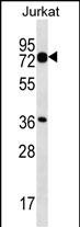 Rabbit Polyclonal Antibody to PLS1