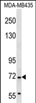 Rabbit Polyclonal Antibody to GRHL2