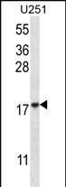 Rabbit Polyclonal Antibody to EIF1AY (N-term)