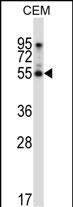 Rabbit Polyclonal Antibody to PALMD (N-term)