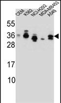 Rabbit Polyclonal Antibody to SSX4