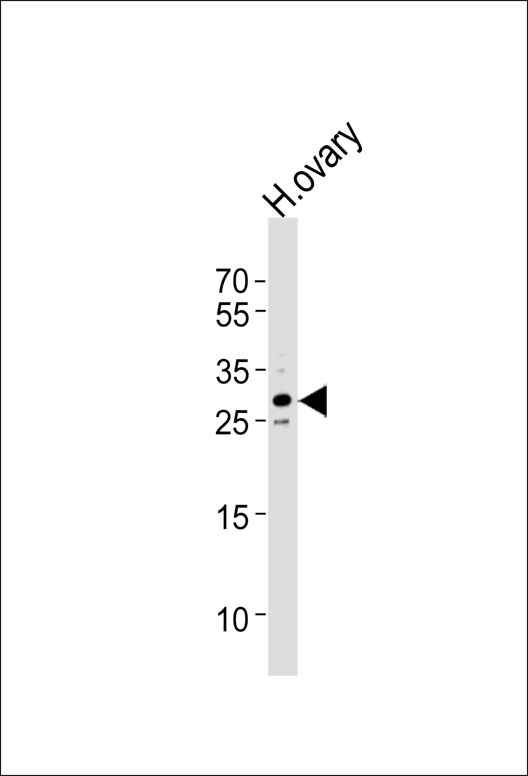 Rabbit Polyclonal Antibody to TRA2A