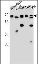 Rabbit Polyclonal Antibody to ASMTL