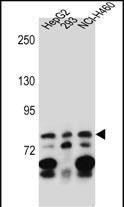 Rabbit Polyclonal Antibody to ZNF555