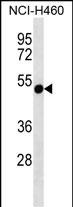 Rabbit Polyclonal Antibody to RTDR1 (N-term)