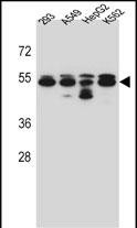 Rabbit Polyclonal Antibody to TUBB8 (N-term)