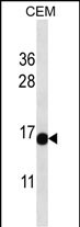 Rabbit Polyclonal Antibody to ATAD4