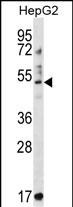 Rabbit Polyclonal Antibody to TRIM11