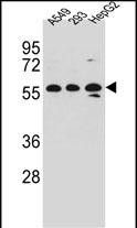 Rabbit Polyclonal Antibody to TRIM4 (N-term)