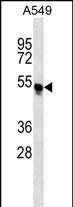 Rabbit Polyclonal Antibody to TRIM54 (N-term)
