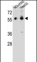 Rabbit Polyclonal Antibody to TRIM64