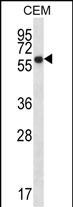 Rabbit Polyclonal Antibody to ERO1L