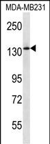Rabbit Polyclonal Antibody to PIK3R4