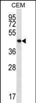 Rabbit Polyclonal Antibody to PTPN2