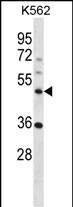Rabbit Polyclonal Antibody to NLE1