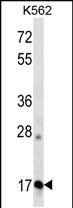 Rabbit Polyclonal Antibody to APOO (N-term )