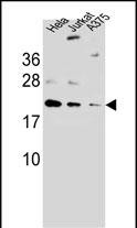 Rabbit Polyclonal Antibody to ARL6IP6 (N-term)