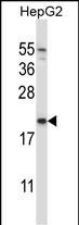 Rabbit Polyclonal Antibody to NDUFAF2