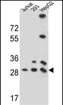 Rabbit Polyclonal Antibody to PGAM4 (N-term)