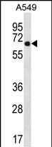 Rabbit Polyclonal Antibody to WSCD2