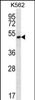 Rabbit Polyclonal Antibody to MORN1 (N-term)