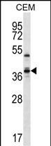 Rabbit Polyclonal Antibody to WDR25