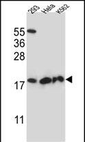 Rabbit Polyclonal Antibody to DHFRL1