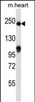 Rabbit Polyclonal Antibody to SLIT1 (N-term)