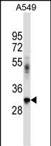 Rabbit Polyclonal Antibody to BNIP2