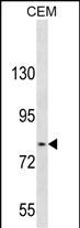 Rabbit Polyclonal Antibody to TGFBRAP1