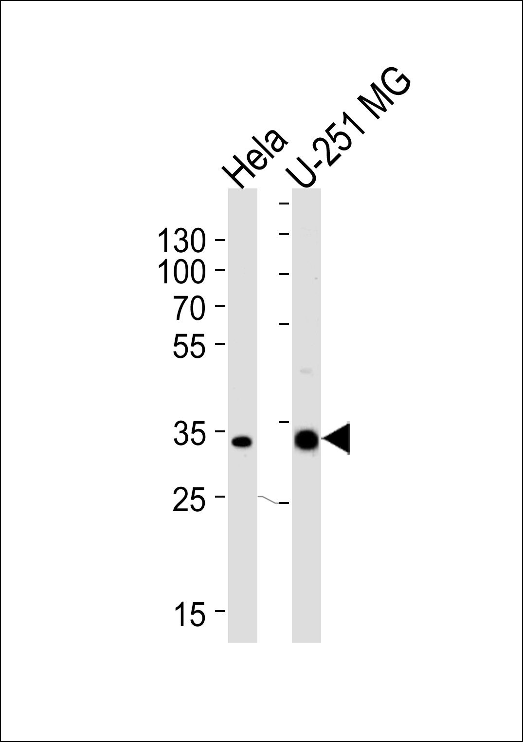 Rabbit Polyclonal Antibody to TAF8