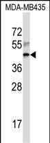 Rabbit Polyclonal Antibody to RPL3