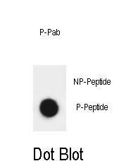 Rabbit Polyclonal Antibody to Phospho-ATRIP(S239)