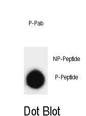 Rabbit Polyclonal Antibody to Phospho-SNAP25(T138)