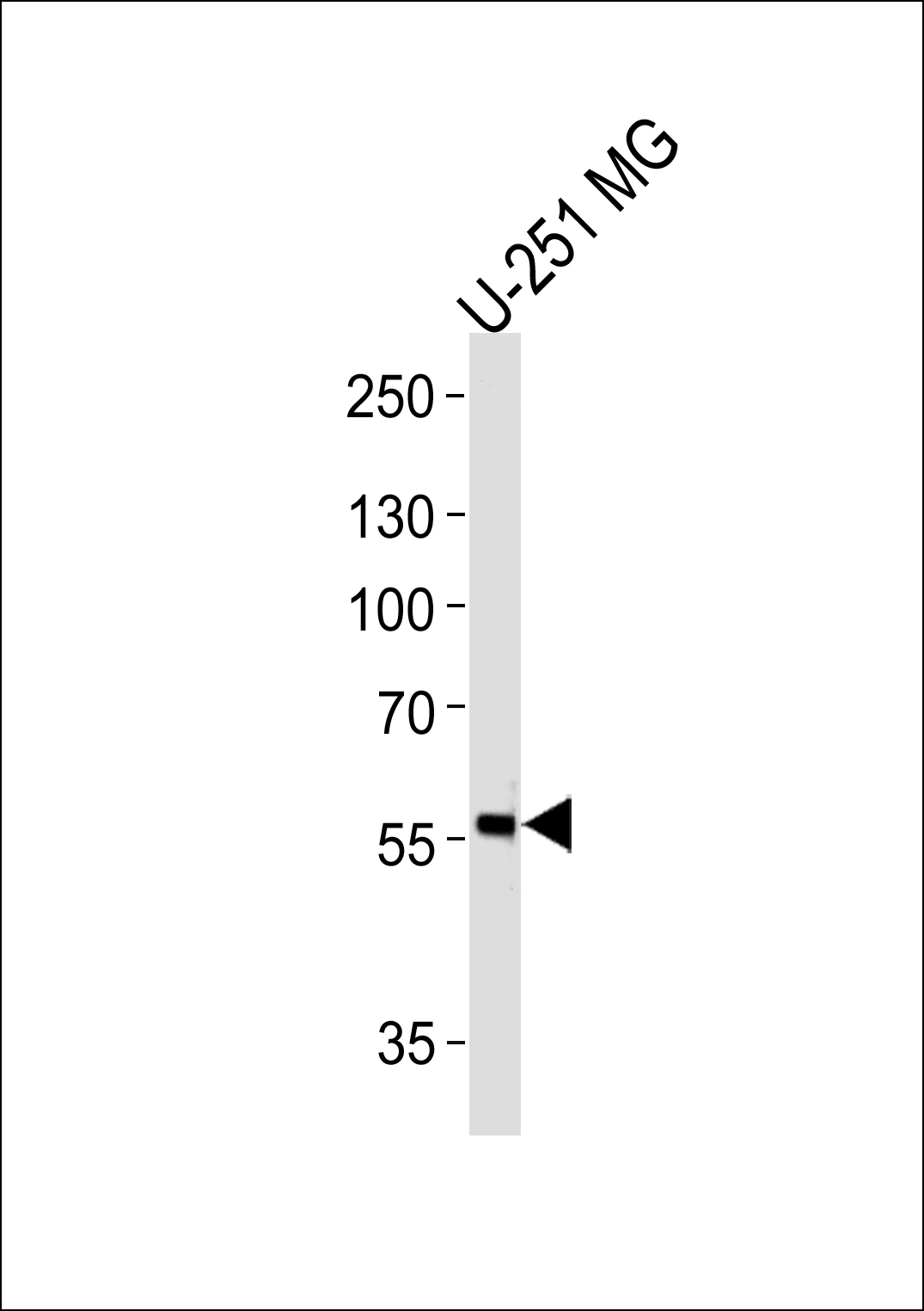 Rabbit Polyclonal Antibody to PHF17 (N-term)