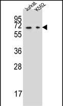 Rabbit Polyclonal Antibody to DPYS