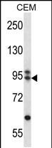 Rabbit Polyclonal Antibody to ARMC9 (N-term)