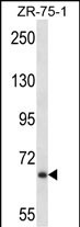 Rabbit Polyclonal Antibody to JPH2