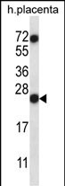 Rabbit Polyclonal Antibody to RNASE8
