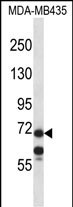 Rabbit Polyclonal Antibody to MID1