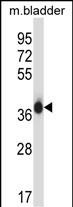 Rabbit Polyclonal Antibody to EIF2S1 (N-term)