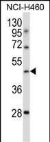 Rabbit Polyclonal Antibody to TLE6 (N-term )