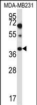 Rabbit Polyclonal Antibody to PTPLA (N-term)