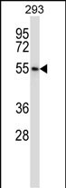 Rabbit Polyclonal Antibody to POLR3D