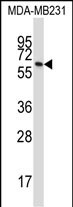 Rabbit Polyclonal Antibody to BTN3A1