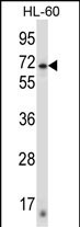 Rabbit Polyclonal Antibody to ZNF415 (N-term)