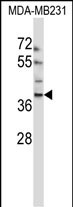 Rabbit Polyclonal Antibody to EMID1 (N-term)