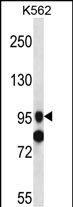 Rabbit Polyclonal Antibody to SIDT1