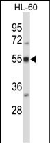 Rabbit Polyclonal Antibody to BAIAP2L2 (N-term)